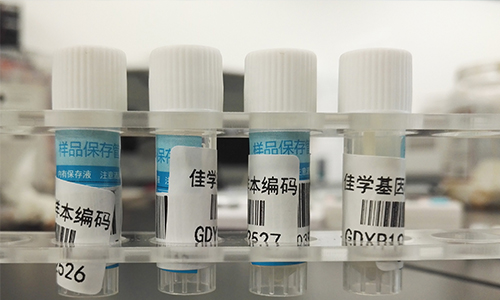 【佳學基因檢測】做Bosch-Boonstra-Schaaf視神經萎縮綜合征基因解碼、<a href=http://www.sushiinoueharlem.com/tk/jiema/cexujishu/2021/31933.html>基因檢測</a>需要多長時間？