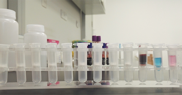 【佳學(xué)基因檢測(cè)】做尼古丁敏感性-毒性/ADR基因解碼、<a href=http://www.sushiinoueharlem.com/tk/jiema/cexujishu/2021/31933.html>基因檢測(cè)</a>需要多長(zhǎng)時(shí)間？