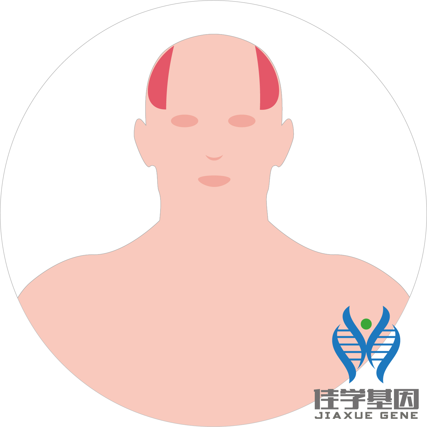 【佳學(xué)基因檢測】男性<font color='red'>脫發(fā)</font>（Androgenetic alopecia）基因解碼、<a href=http://www.sushiinoueharlem.com/tk/jiema/cexujishu/2021/31933.html>基因檢測</a>