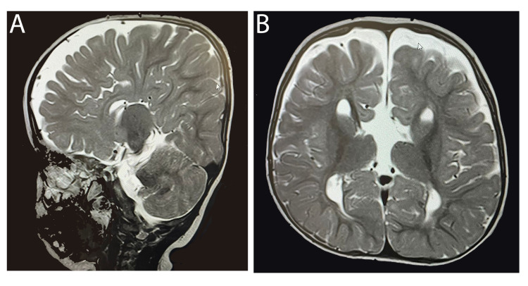 An external file that holds a picture, illustration, etc.
Object name is cureus-0014-00000021063-i01.jpg