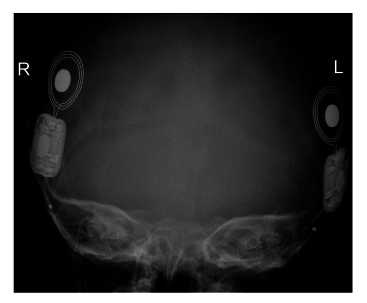 An external file that holds a picture, illustration, etc.
Object name is cureus-0014-00000021063-i02.jpg