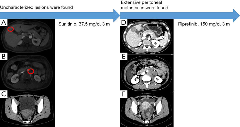 An external file that holds a picture, illustration, etc.
Object name is jgo-13-05-2620-f2.jpg