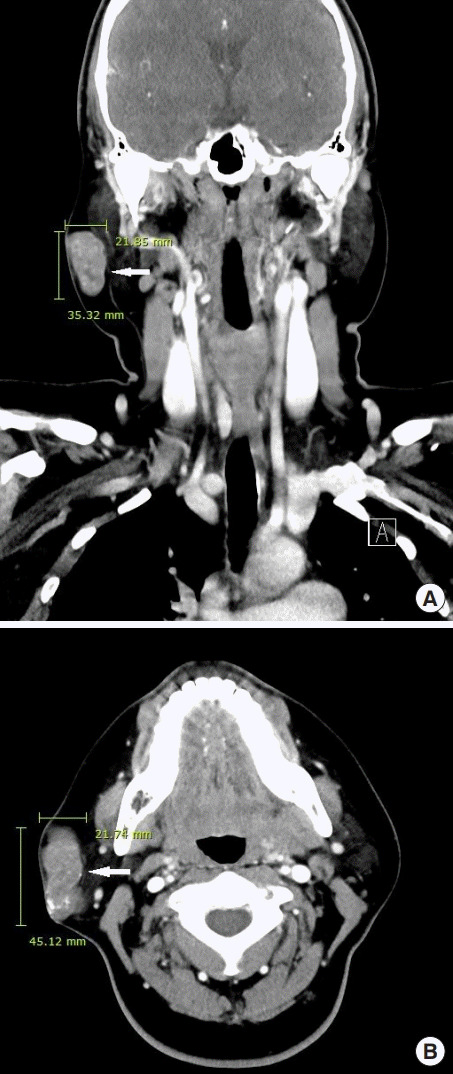 An external file that holds a picture, illustration, etc.
Object name is acfs-2019-00710f3.jpg