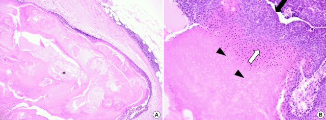 An external file that holds a picture, illustration, etc.
Object name is acfs-2019-00710f5.jpg