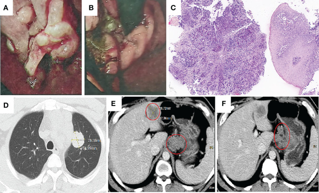 An external file that holds a picture, illustration, etc.
Object name is fimmu-13-1049518-g001.jpg