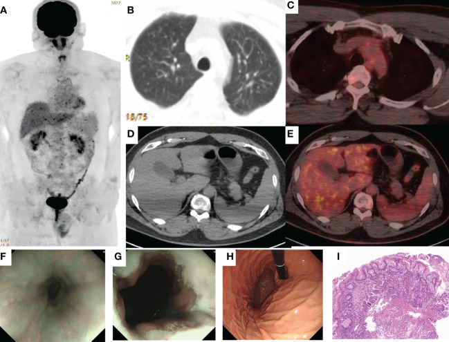 An external file that holds a picture, illustration, etc.
Object name is fimmu-13-1049518-g003.jpg