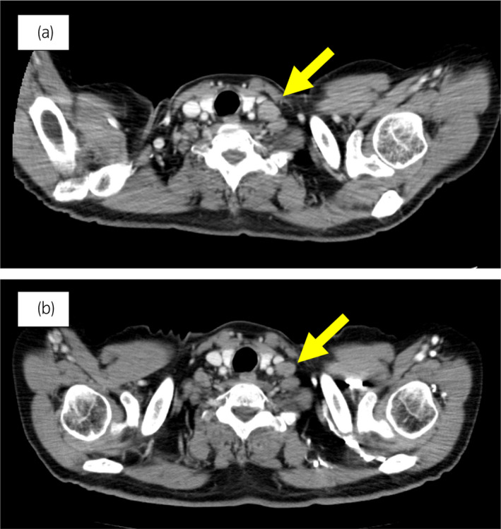 An external file that holds a picture, illustration, etc.
Object name is IJU5-6-37-g002.jpg