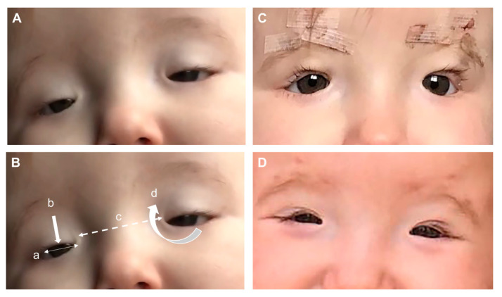 An external file that holds a picture, illustration, etc.
Object name is genes-12-00364-g002.jpg