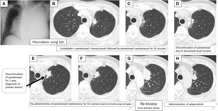An external file that holds a picture, illustration, etc.
Object name is fonc-12-1019932-g001.jpg