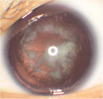 An external file that holds a picture, illustration, etc.
Object name is 12886_2017_503_Fig1_HTML.jpg